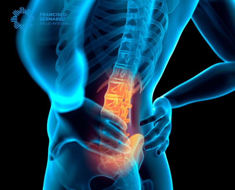 Dolor lumbar, causas y tratamiento para resolverlo - FB Salud Integral ...